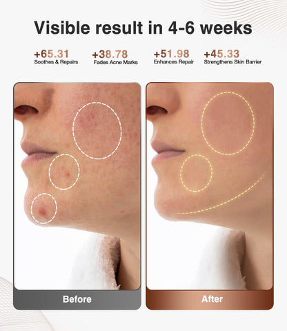 3D LED Beauty Mask – 4 Light Modes, 328 LEDs